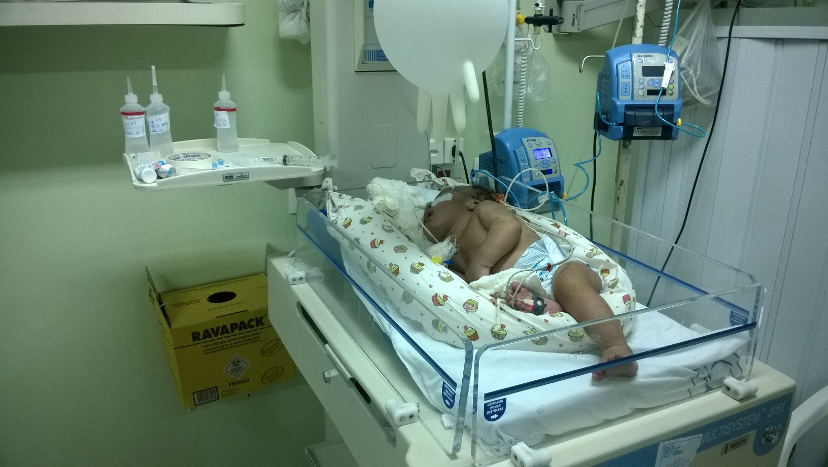 Bebê vai completar 3 meses à espera de cirurgia pelo SUS