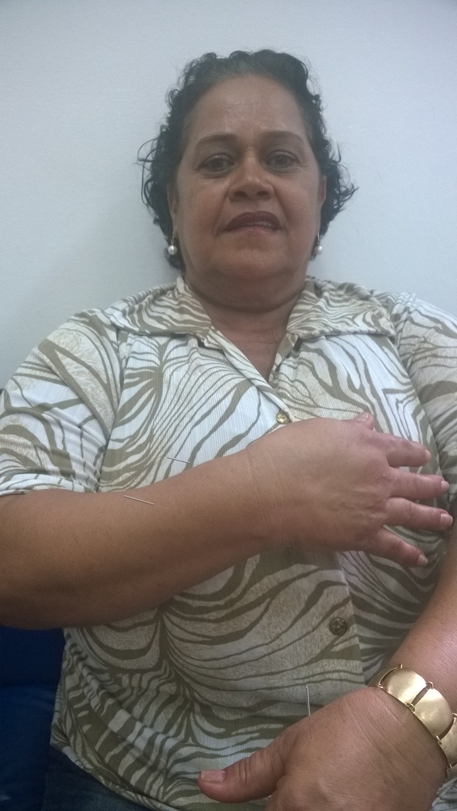 Rede municipal oferece acupuntura