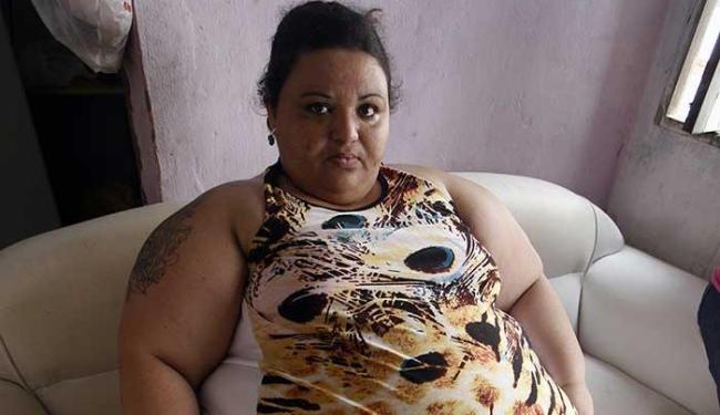 Obesa de Feira de Santana inicia tratamento no Hospital da Bahia