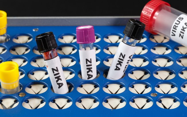 A partir de quarta-feira planos pagam exame de zika 