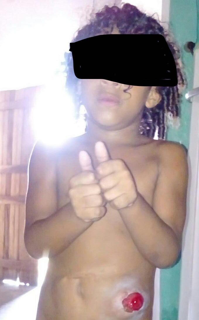 Criança de cinco anos espera cirurgia no Hospital da Criança desde que nasceu