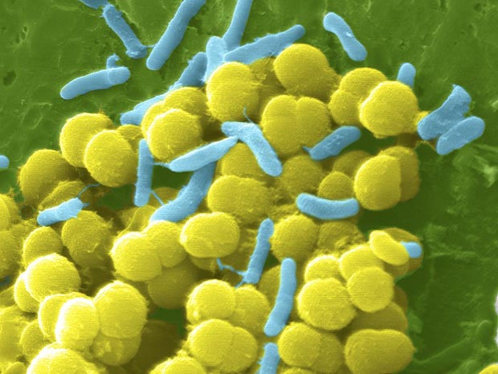 Staphylococcus aureus: entenda o que é a bactéria que pode causar sepse, a infecção generalizada