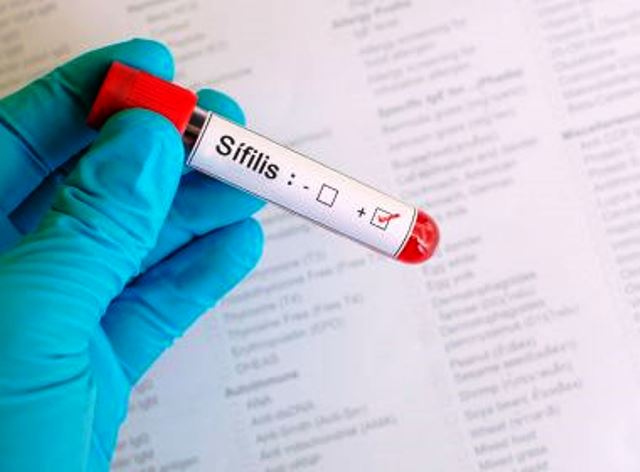 Em 5 anos, Bahia registrou 396 casos de sífilis em meninas menores de 14 anos