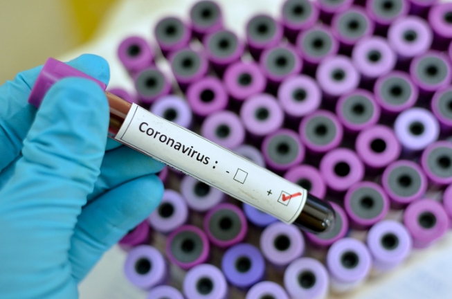 83 dos 431 casos confirmados de Covid-19 na Bahia já estão recuperados