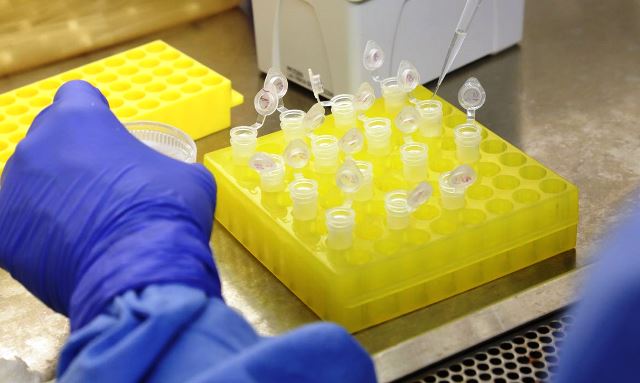 Bahia tem 30 novos casos e número de infectados pelo coronavírus chega a 431; 10 pessoas morreram