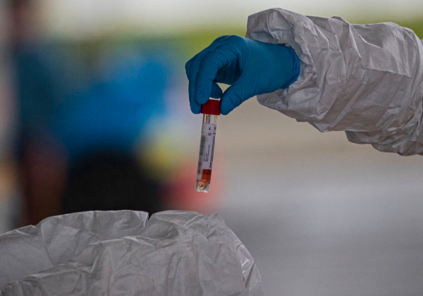 Estudo indica que maioria de infectados cria anticorpos contra novo coronavírus