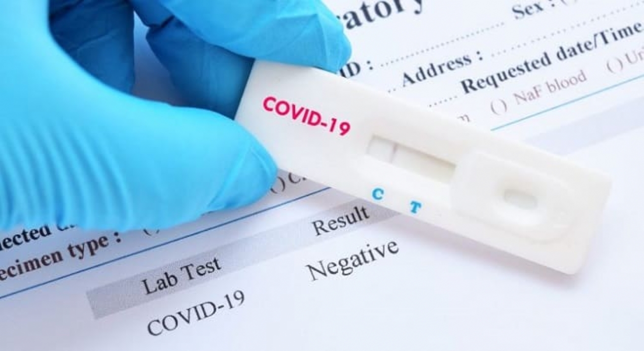 Média móvel de novos casos de Covid-19 cai 30 por cento em relação há duas semanas