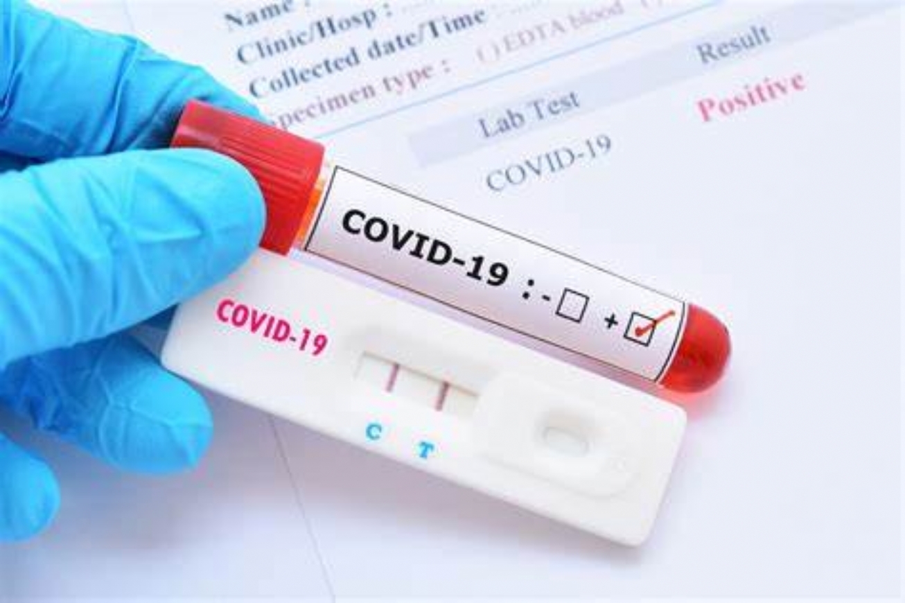 Veja a lista atualizada de casos da Covid-19 por bairros e localidades