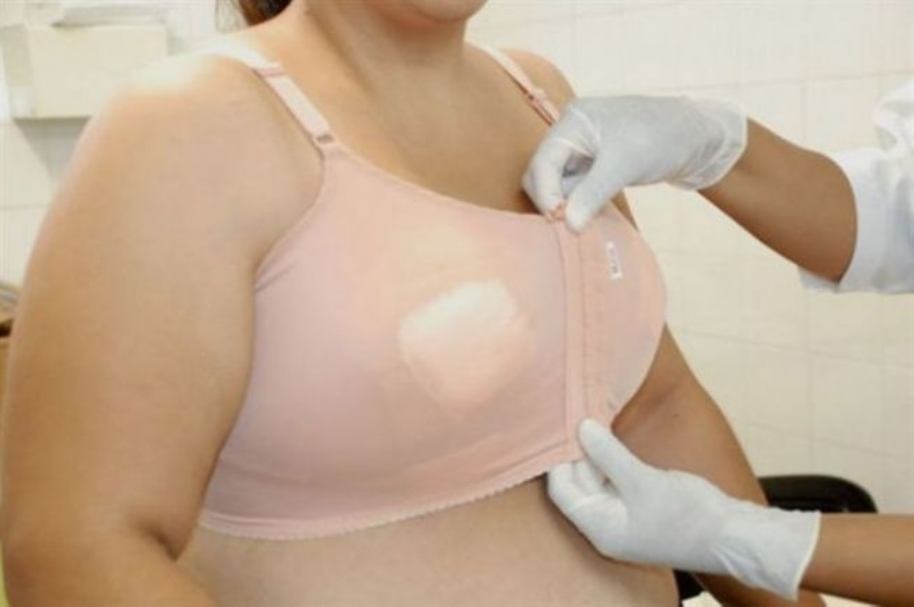 Divulgado nomes de mulheres aptas à segunda etapa do Programa de Gigantomastia