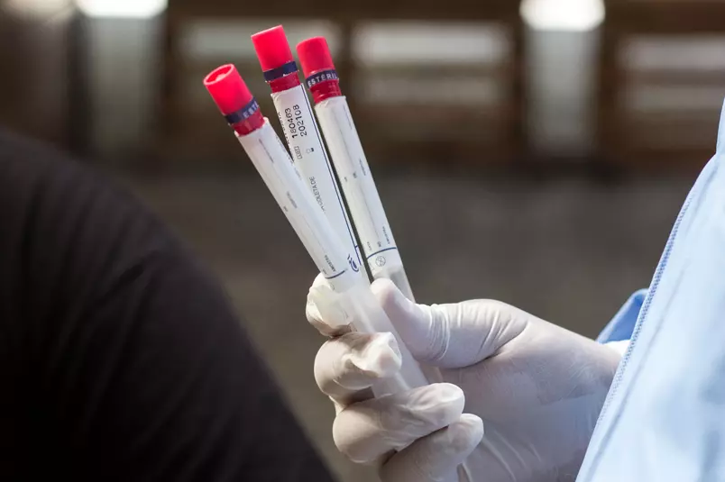 Ministério da Saúde confirma primeiro caso de reinfecção por Covid-19 no Brasil