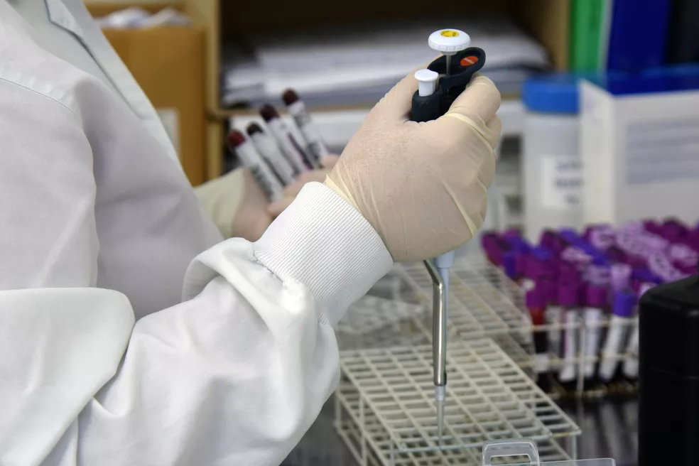 Com cerca de 13 mil testes de Covid-19 para analisar, Lacen opera em sobrecarga na BA