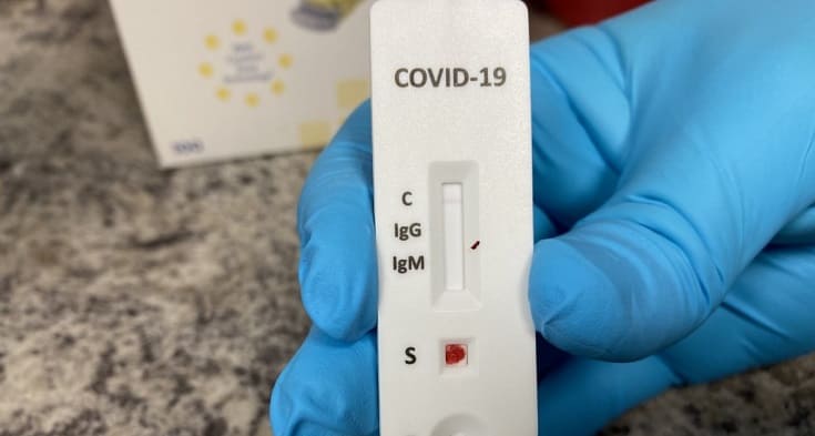 55 novos casos de Covid-19 são registrados, neste domingo (24), em Feira de Santana
