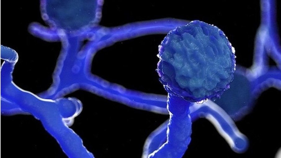 Mucormicose no Brasil: Hospital das Clínicas de SP investiga caso de fungo negro em paciente com Covid-19