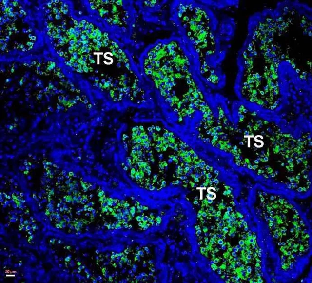 Estudo realizado na UFMG demonstra que testículos podem servir de 'santuário viral' para o novo coronavírus