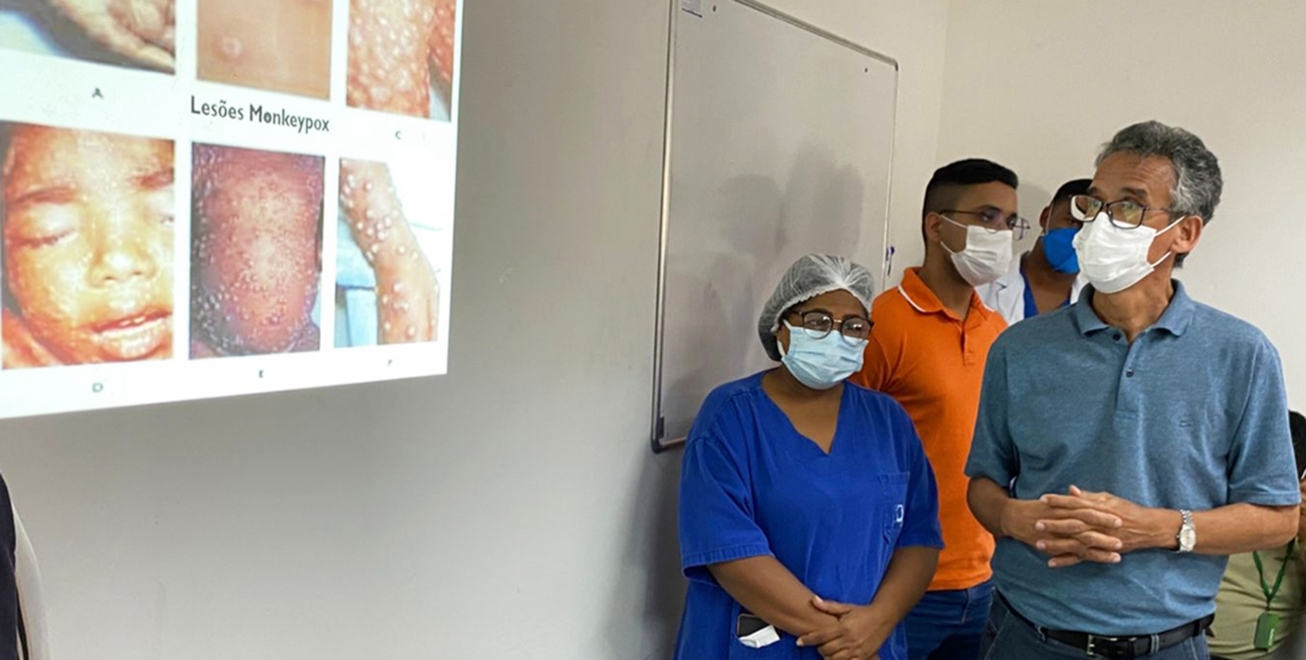 Profissionais de saúde são capacitados para diagnóstico da varíola dos macacos