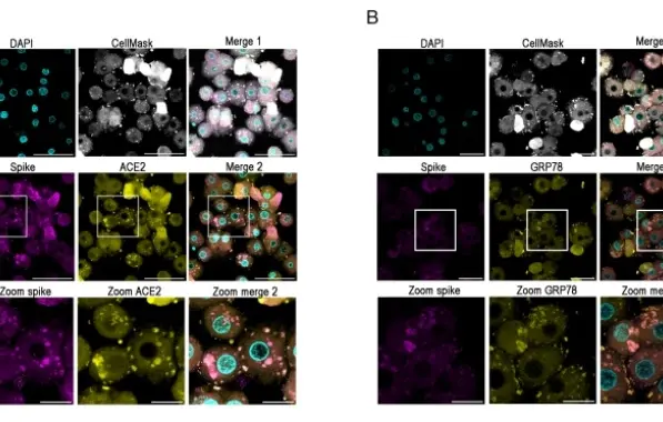 Estudo da USP mostra que vírus da Covid infecta fígado, estimula produção de glicose e agrava o quadro clínico